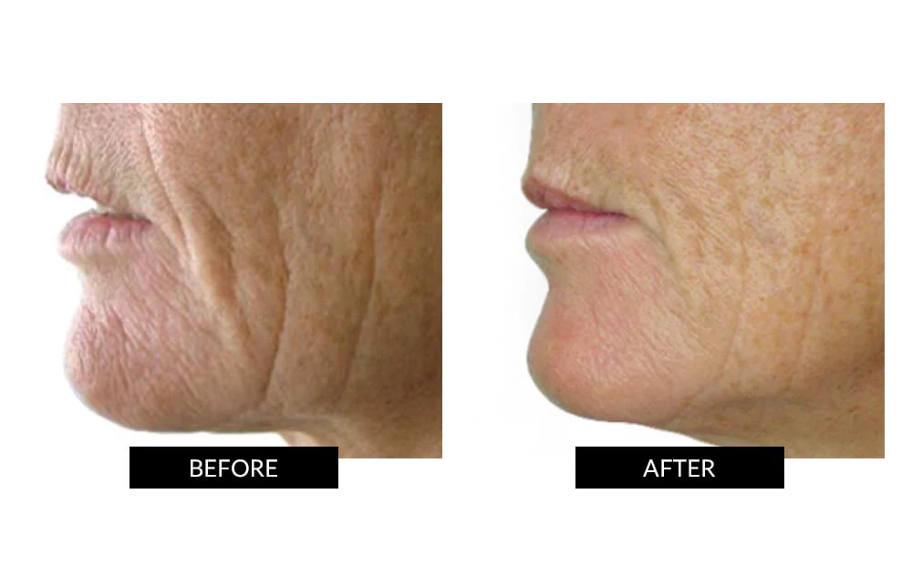 CurrentBody Skin LED Light Therapy Mask + Hydrogel - Image 6