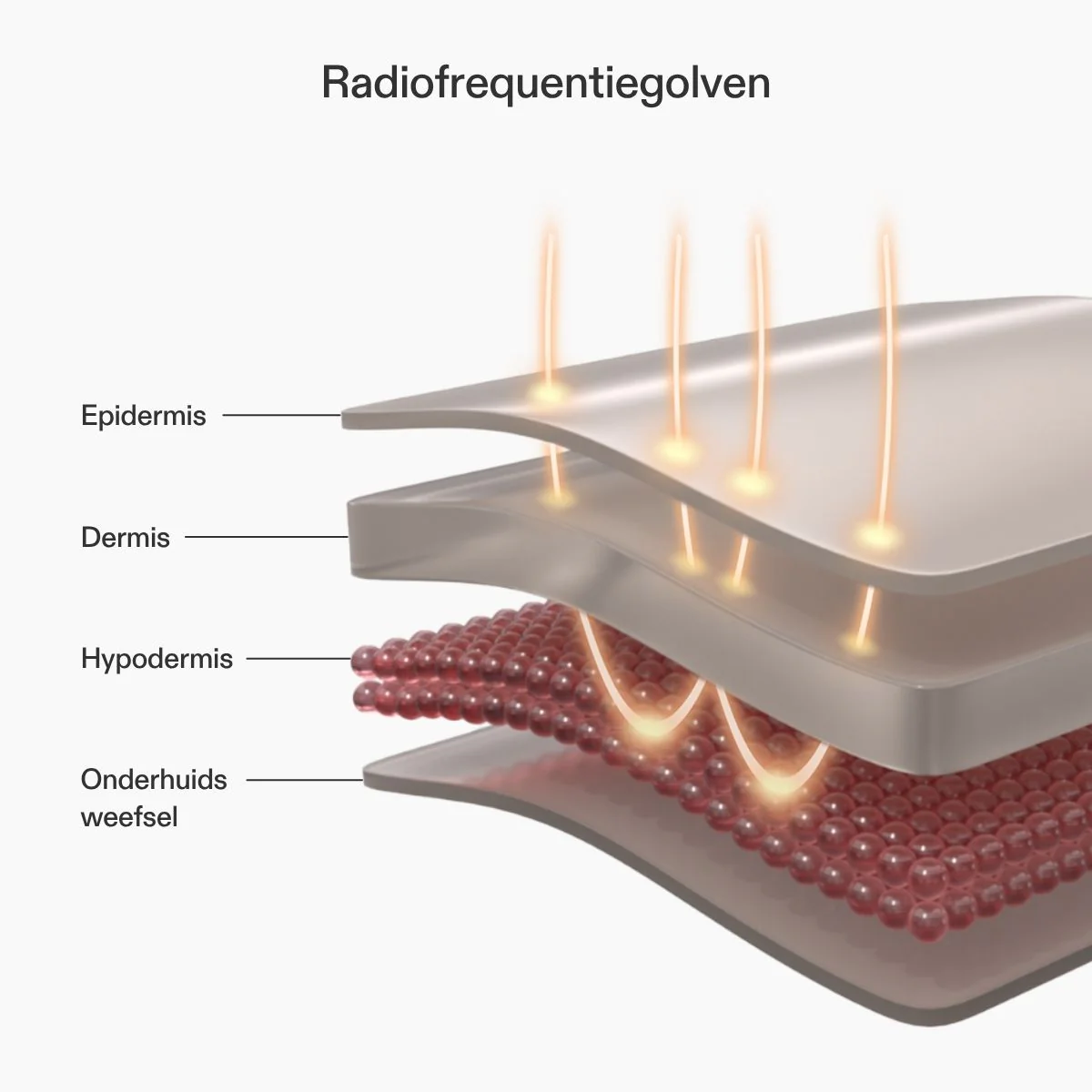 CurrentBody Skin RF-apparaat - Image 4
